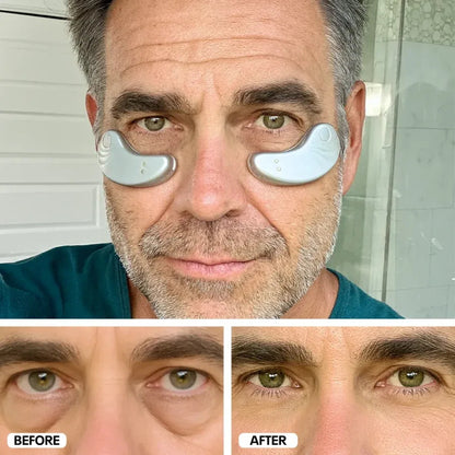 LorenceActive™ Eyepods